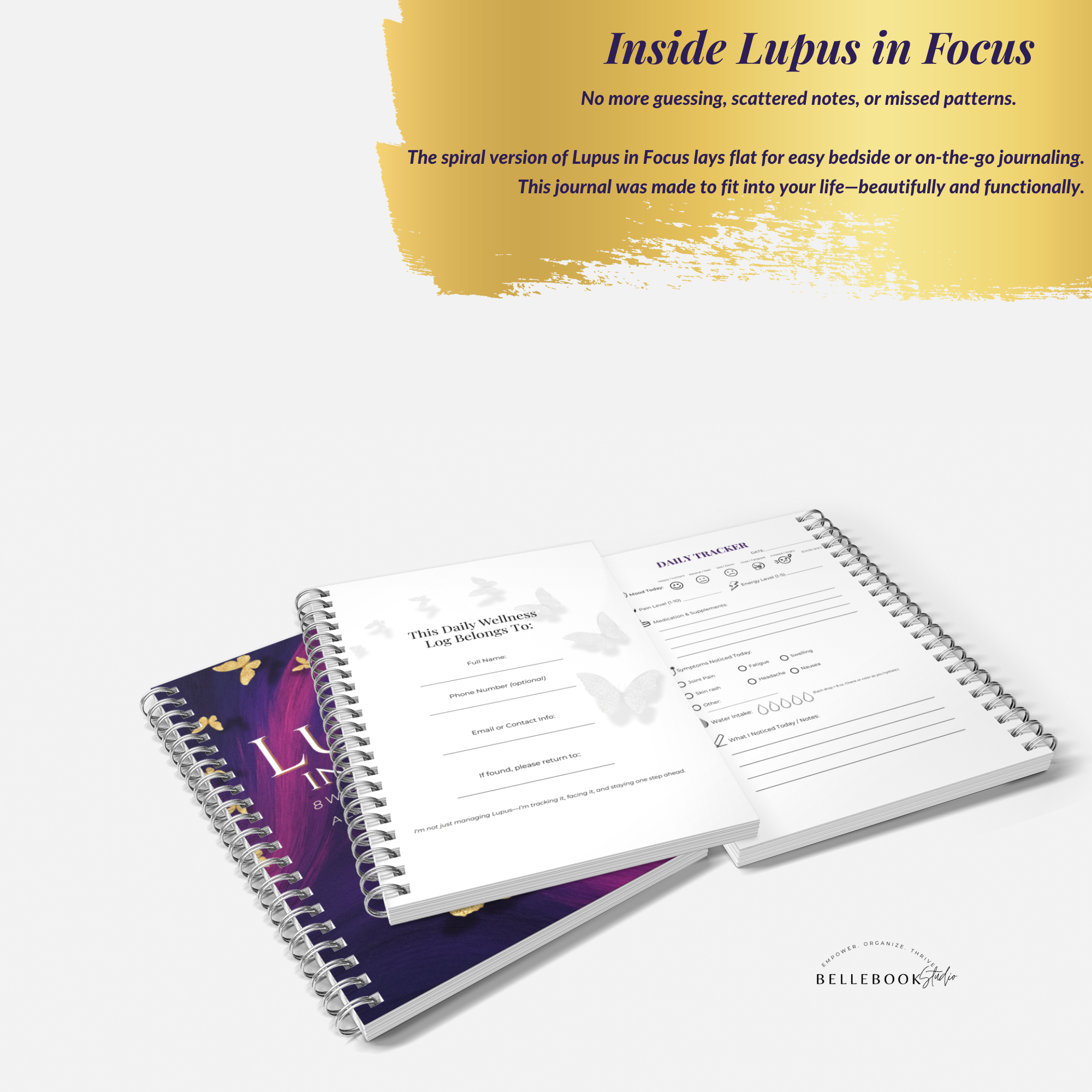 Lupus in Focus – 90-Day Perfect Bound Symptom Tracker for Flare-Ups, Meds & Wellness