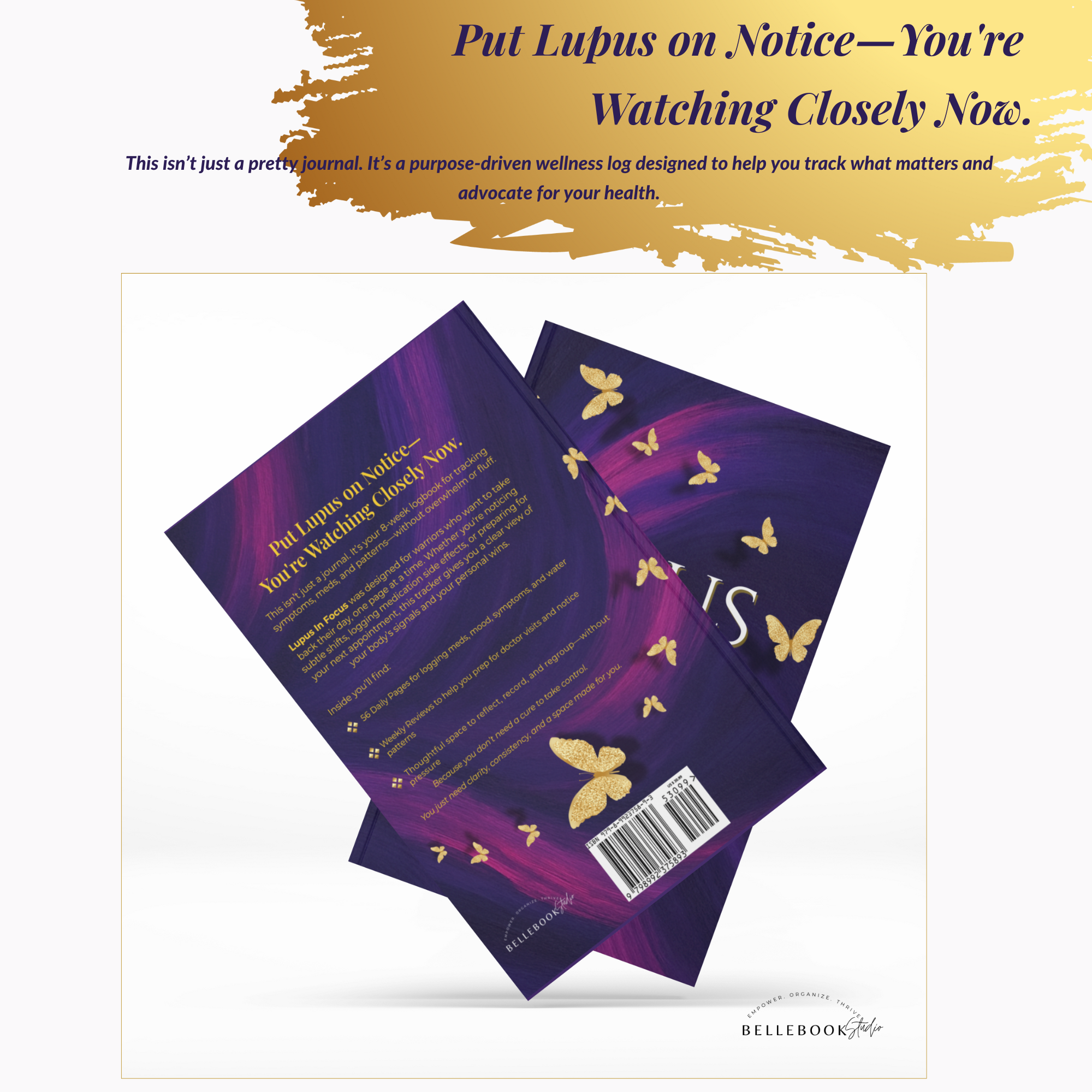 Lupus in Focus – 90-Day Perfect Bound Symptom Tracker for Flare-Ups, Meds & Wellness