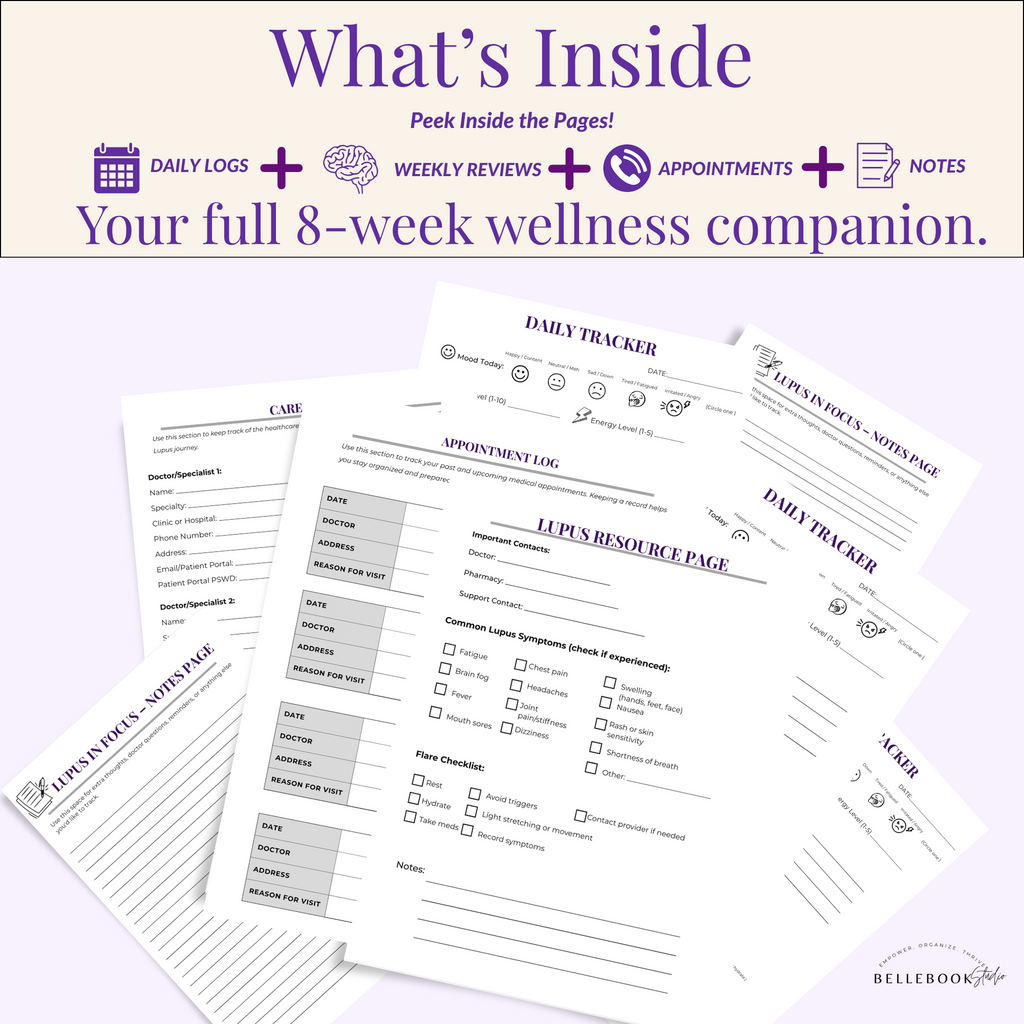 Lupus in Focus – 90-Day Perfect Bound Symptom Tracker for Flare-Ups, Meds & Wellness